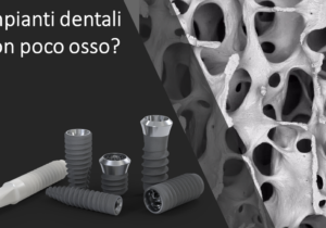 Impiantologia Poco Osso (Scarsa dentità Ossea): Soluzioni Avanzate