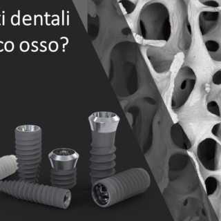 Impiantologia Poco Osso (Scarsa dentità Ossea): Soluzioni Avanzate